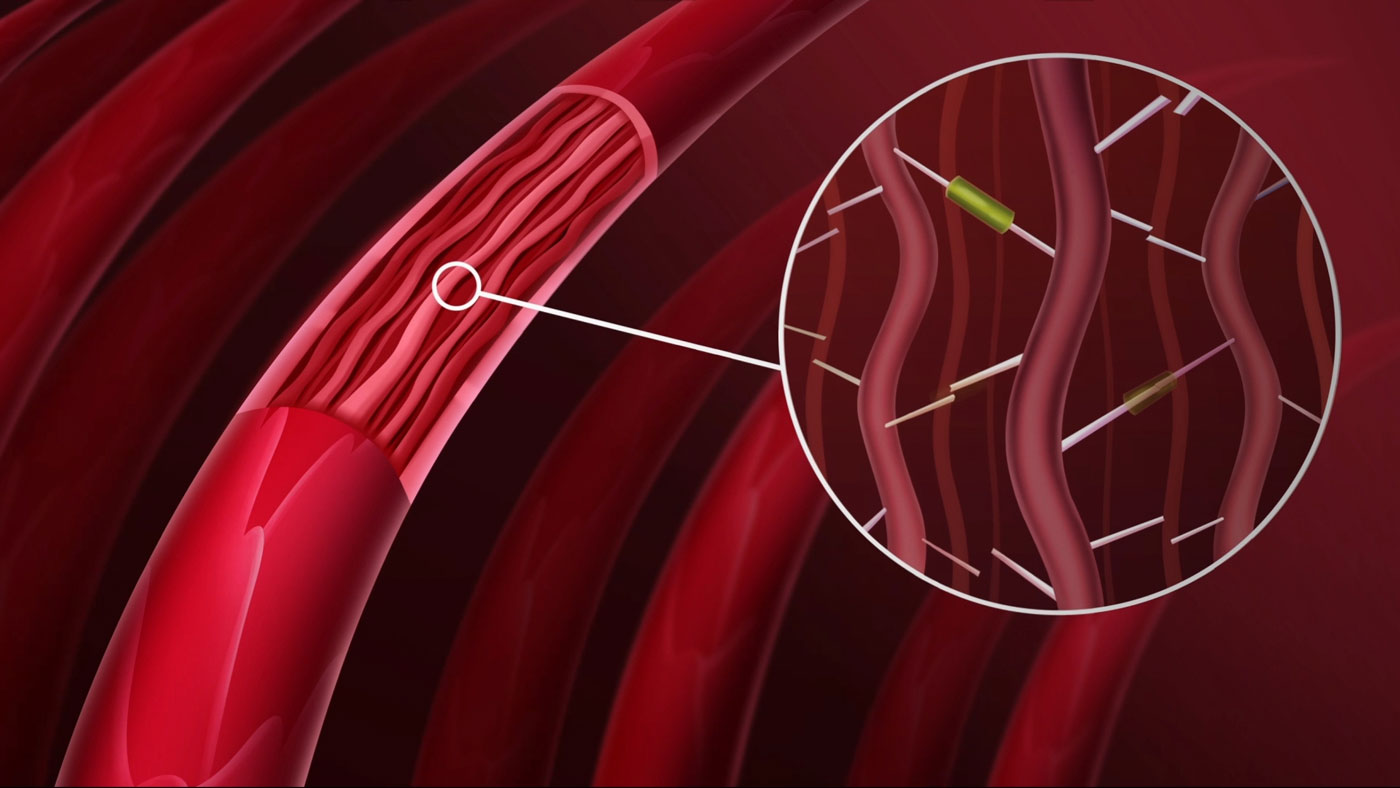 Load video: Video explainig how Bond Booster by XMONDO Hair works